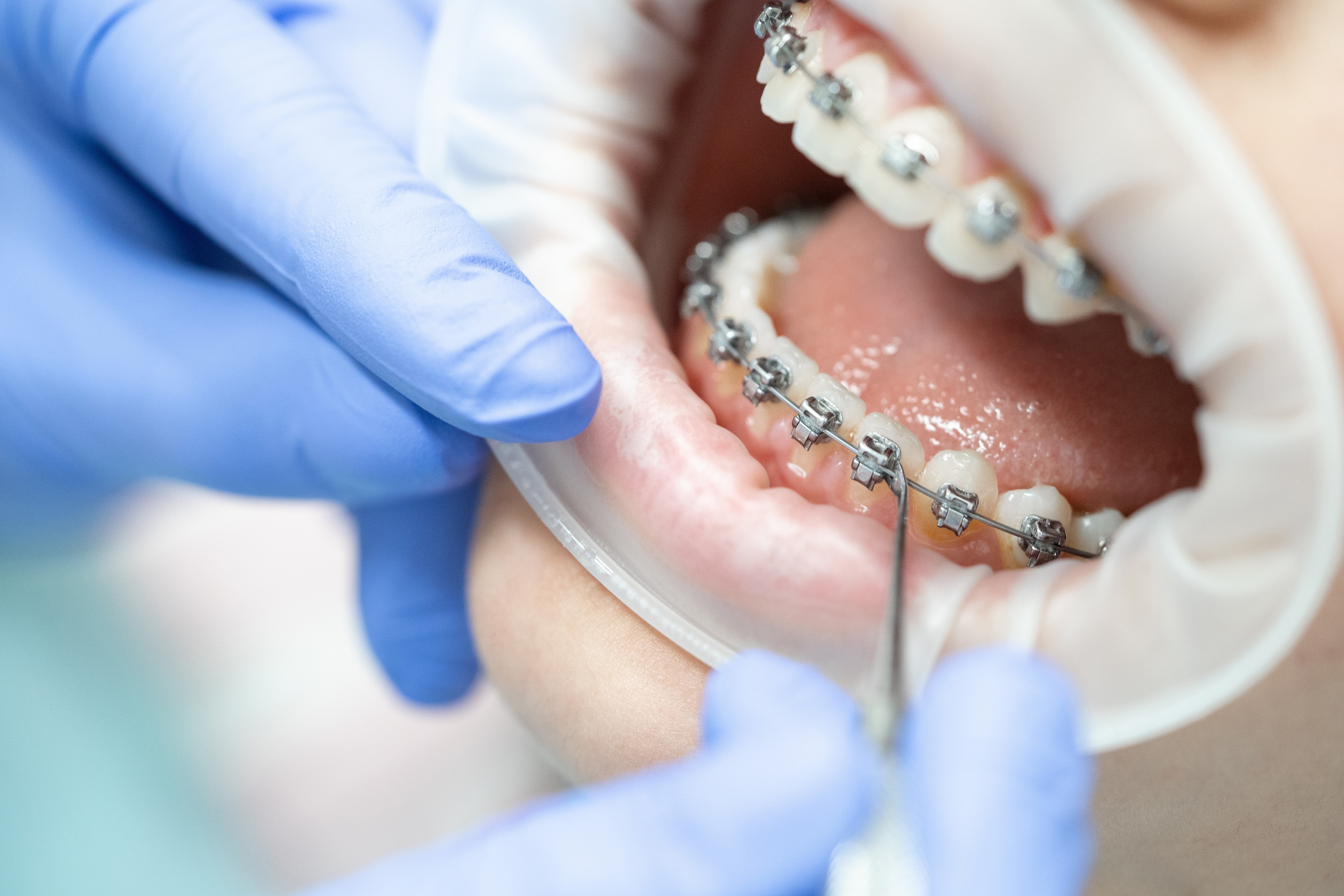 Orthodontics 3