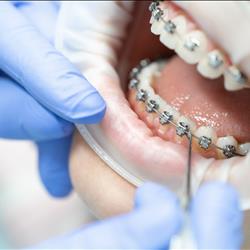 Orthodontics 3