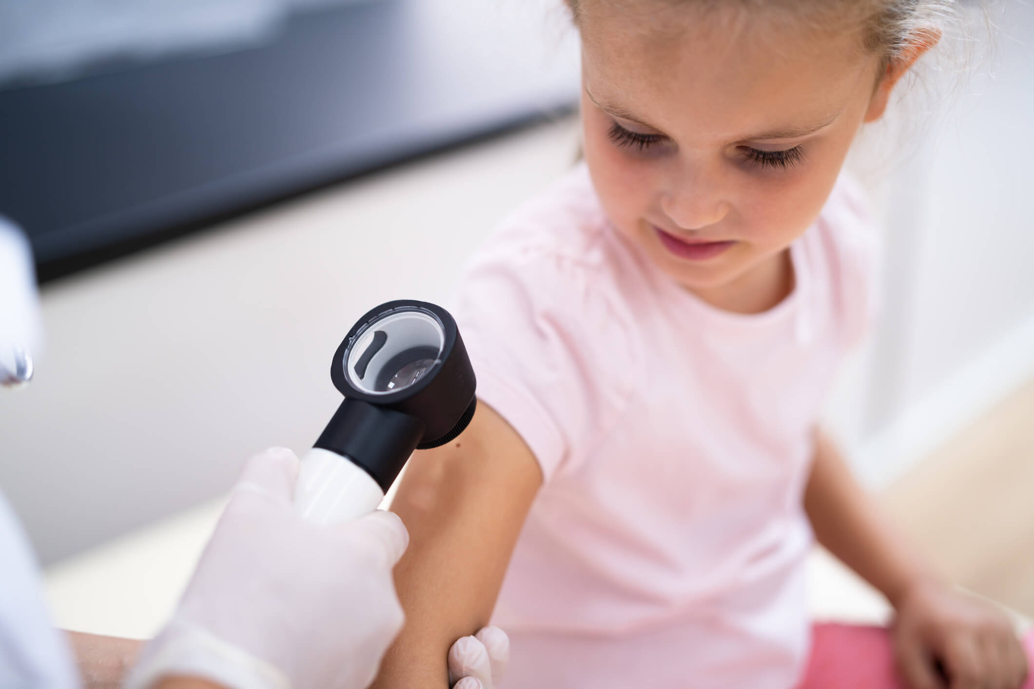 Insights into Paediatric Dermatology
